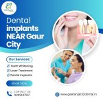 Dental implants NEAR Gaur City.jpg