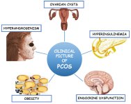 PCOS and PCOD.jpg