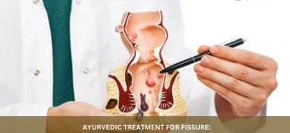 best fissure doctor in Dwarka.jpg